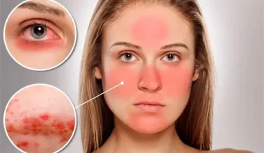The Spiritual Meaning of Face Burning Sensation:All You Need To Know