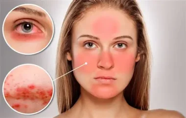 The Spiritual Meaning of Face Burning Sensation:All You Need To Know