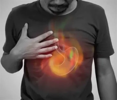 The The Spiritual Meaning of Heartburn: What Is Your Body Trying to Reject?:Everything You Need To Know